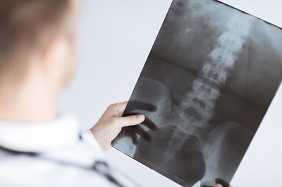 Bester Hüftchirurg in Graz – Patientenbewertungen und Erfahrungsberichte